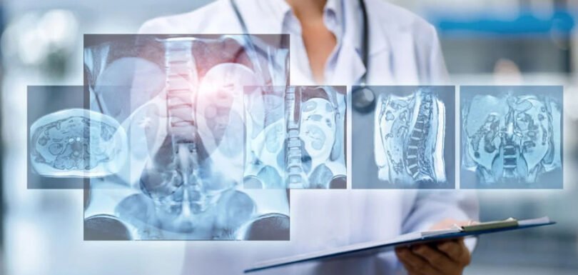 Diagnostica del dolore cronico