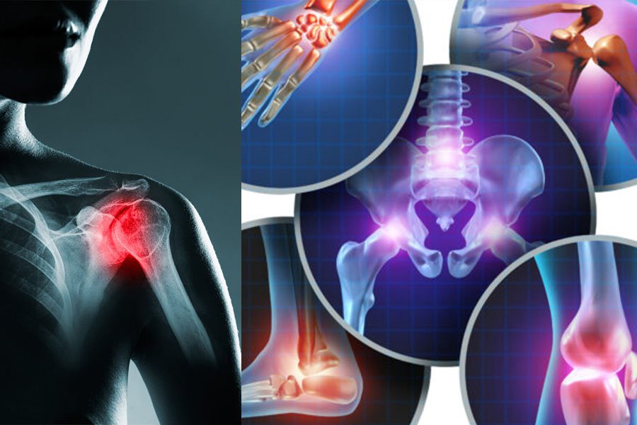 infiltrazione-ecoguidata-1-1