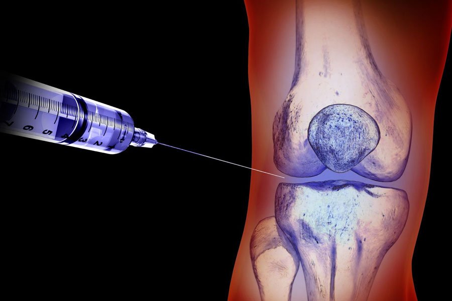 infiltrazioni-intrarticolare