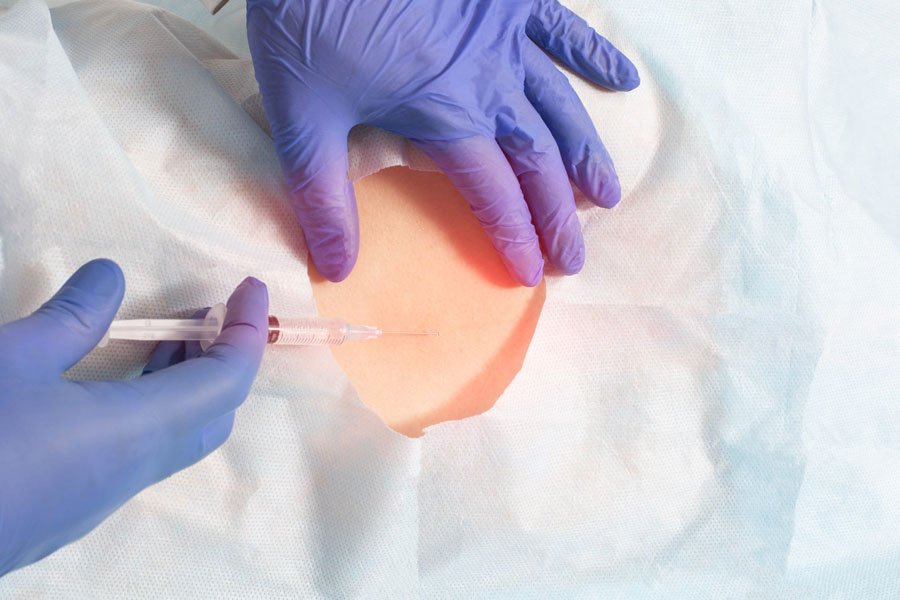 infiltrazioni-lo-bianco-epidurale-1