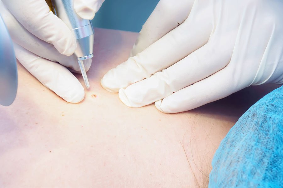 ozonoterapia-lo-bianco-2