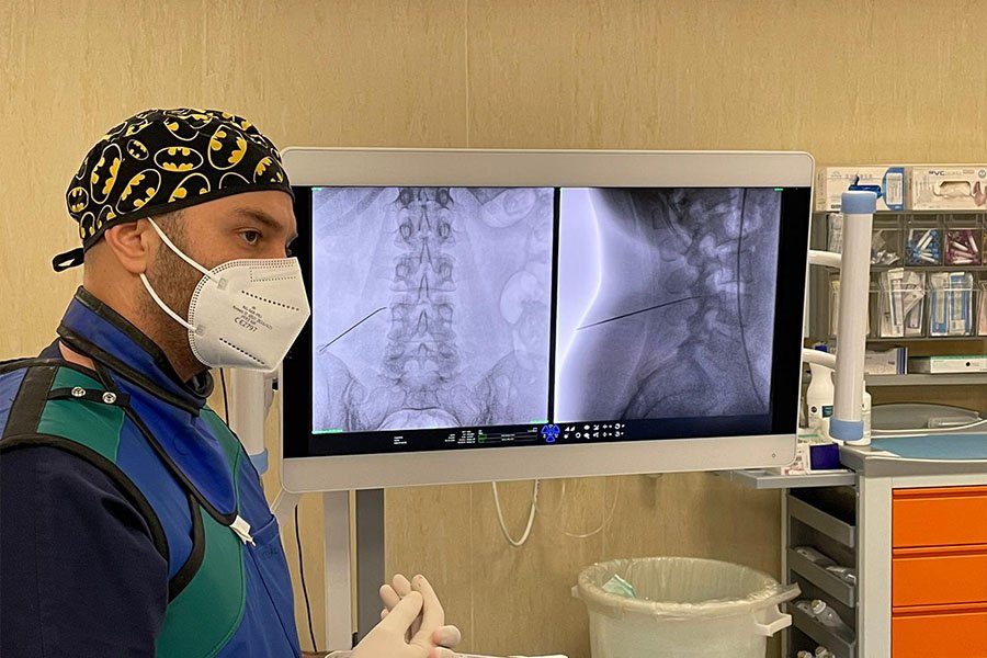 radiofrequenza-lo-bianco