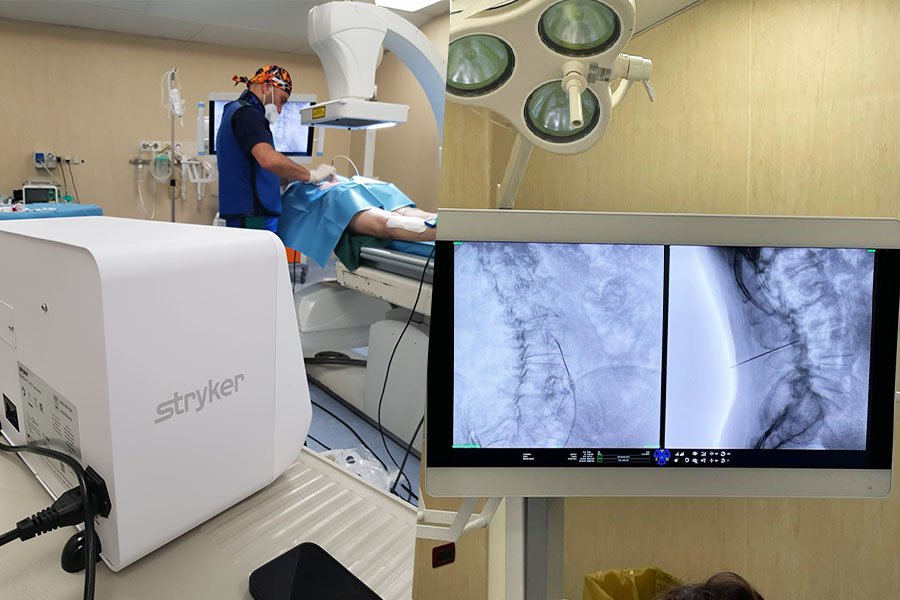 radiofrequenza-lo-bianco3