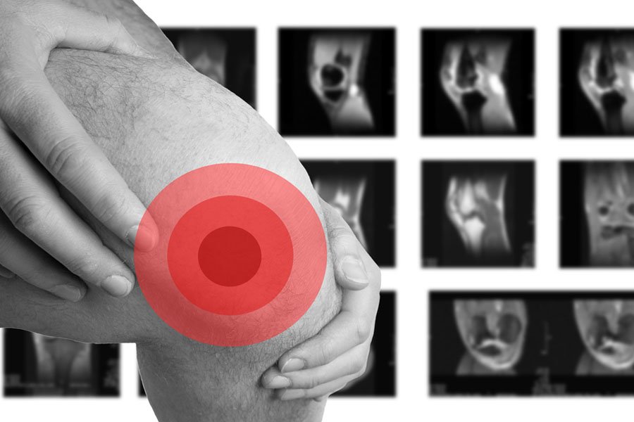 rx-ginocchio-lo-bianco-1