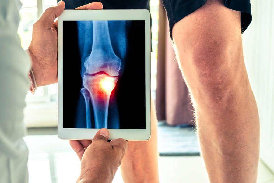 rx-ginocchio-lo-bianco