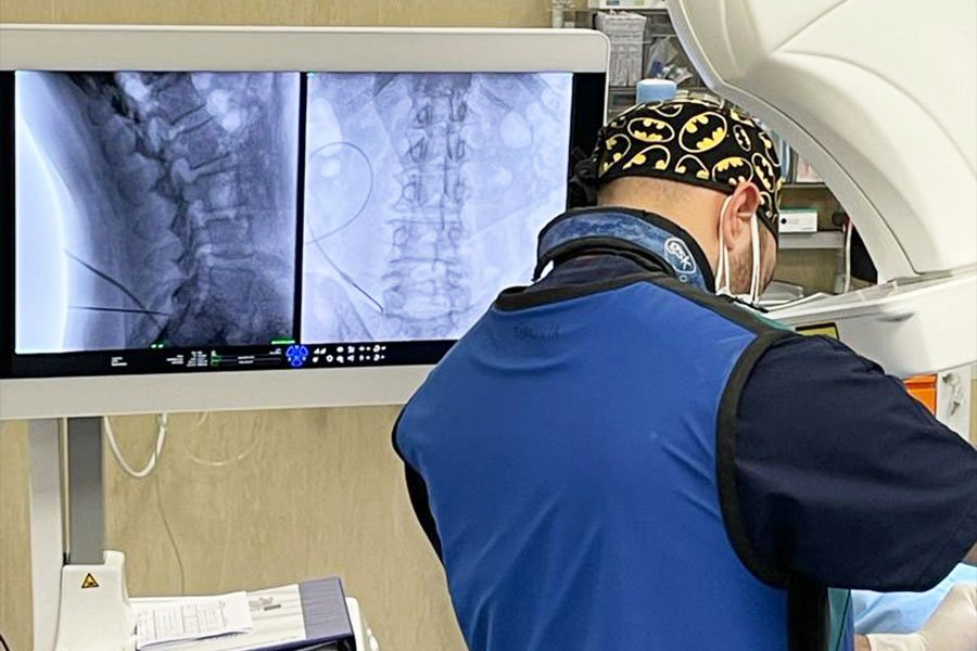 denevarzione-dellarticolazione-sacroiliaca