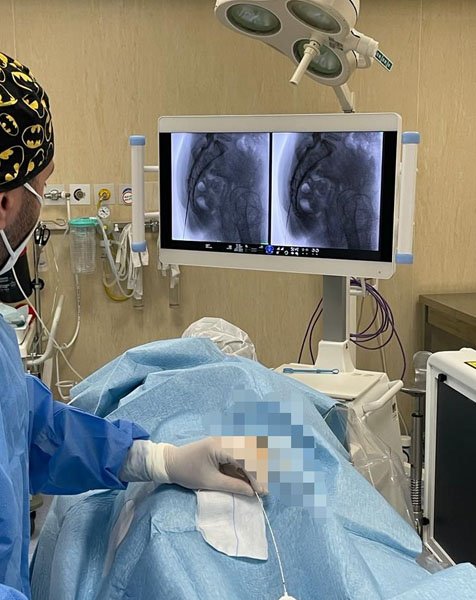 epidurolisi_0003_Livello-3