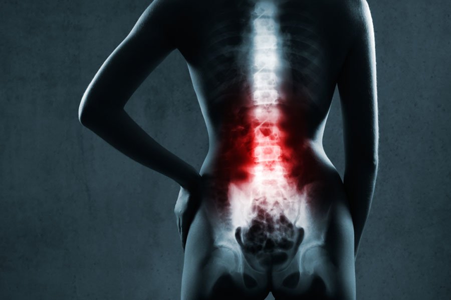 radiofrequenza-NEUROMODULAZIONE_1