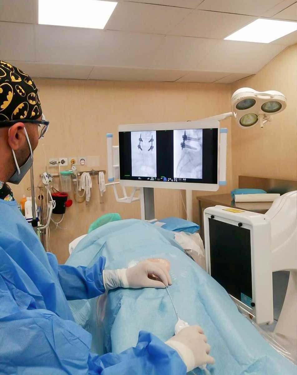 epidurolisi-radiofrequenza-gangliare