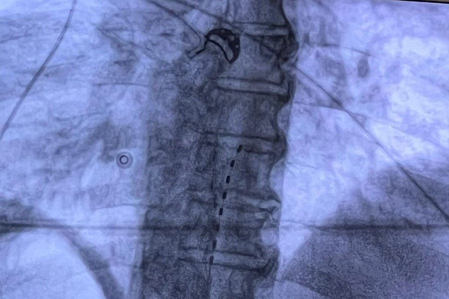 neuromodulazione-elettrica-2