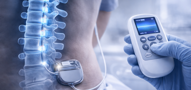 Neurostimolazione midollare per il dolore cronico