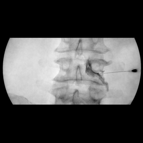 3f6d615fa313788c-infiltrazioni