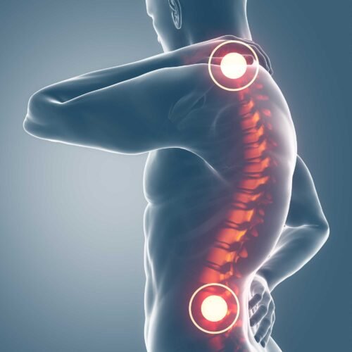 fca2389e4ab4f7cb-dolore-cronico